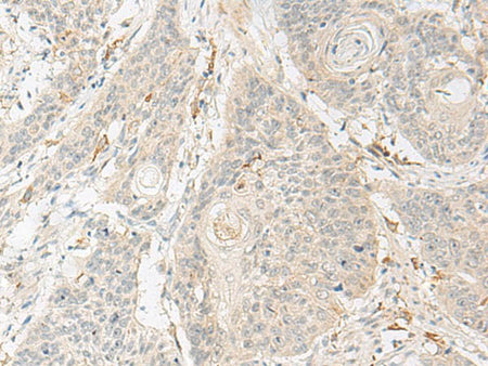 GNAT3 Polyclonal Antibody Store at -20°C