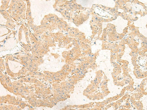 GNAT3 Polyclonal Antibody Store at -20°C