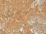 GPR1 Polyclonal Antibody