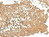 PRLHR Polyclonal Antibody