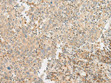 GPR119 Polyclonal Antibody