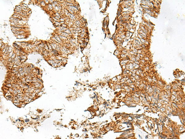 GPR119 Polyclonal Antibody