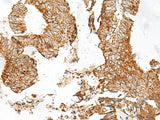 GPR119 Polyclonal Antibody