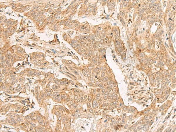ADGRF1 Polyclonal Antibody