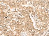ADGRF1 Polyclonal Antibody