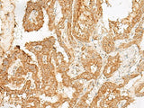 ADGRF1 Polyclonal Antibody