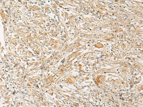 GPR22 Polyclonal Antibody