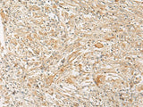 GPR22 Polyclonal Antibody