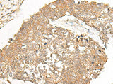 POLR2L Polyclonal Antibody