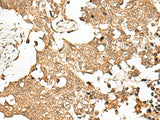 SNAPC5 Polyclonal Antibody