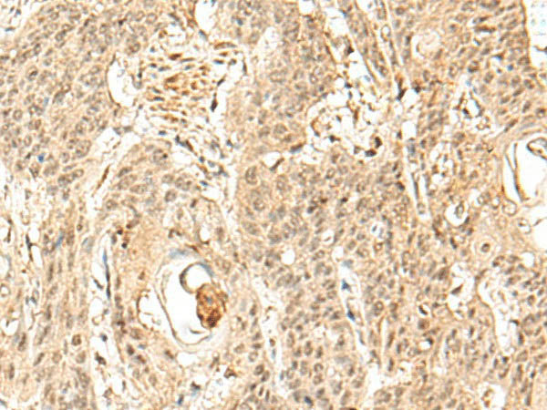 SNAPC5 Polyclonal Antibody