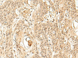 SNAPC5 Polyclonal Antibody