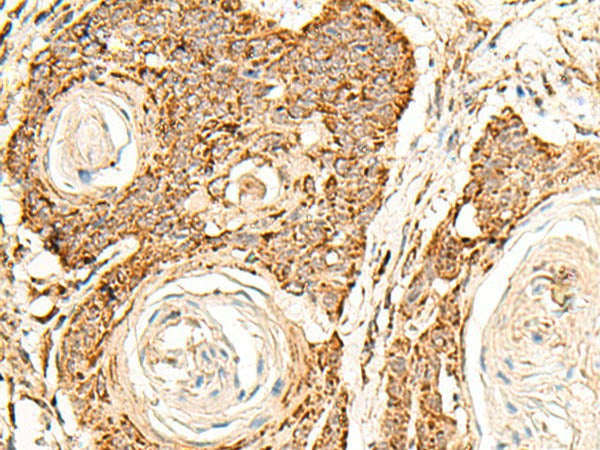 ATP5I Polyclonal Antibody