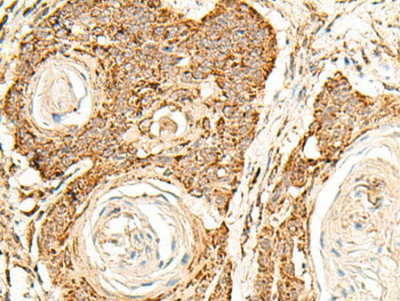 ATP5I Polyclonal Antibody
