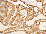 ATP5I Polyclonal Antibody