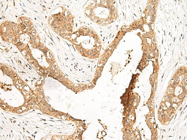 LDHA Polyclonal Antibody