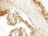 LDHA Polyclonal Antibody