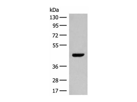GPR52 Polyclonal Antibody
