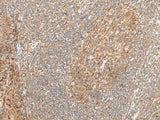 GPR62 Polyclonal Antibody