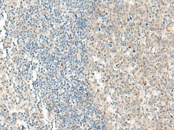 NPBWR1 Polyclonal Antibody