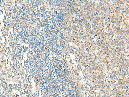 NPBWR1 Polyclonal Antibody