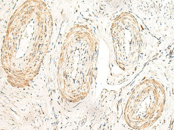 GPR160 Polyclonal Antibody