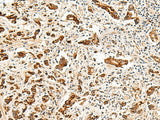 GPR160 Polyclonal Antibody
