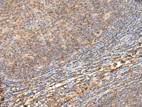 ADGRA1 Polyclonal Antibody