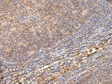 ADGRA1 Polyclonal Antibody