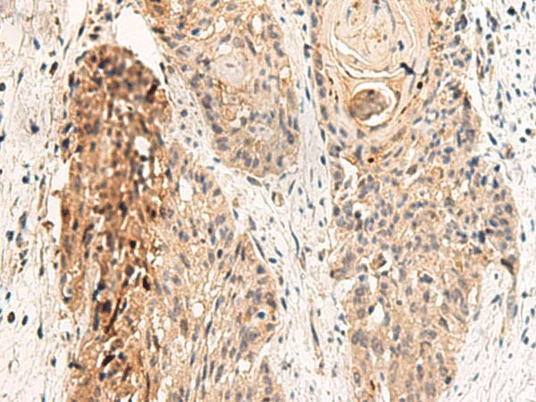 GPR152 Polyclonal Antibody