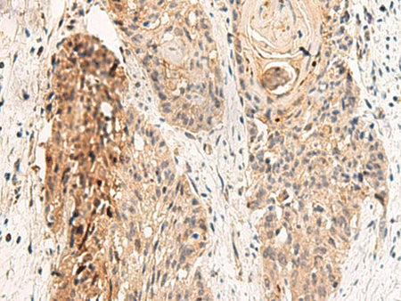 GPR152 Polyclonal Antibody