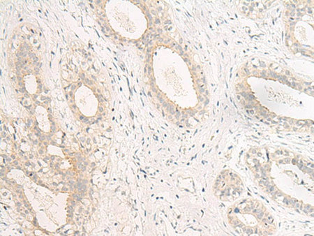 GPR157 Polyclonal Antibody