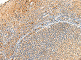 GPR161 Polyclonal Antibody