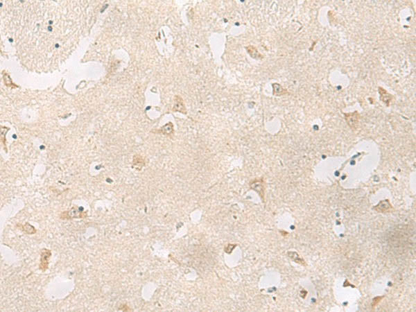 GPR83 Polyclonal Antibody