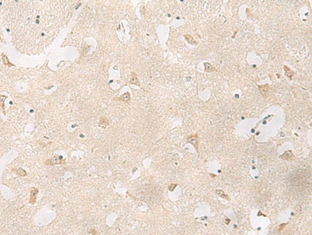 GPR83 Polyclonal Antibody
