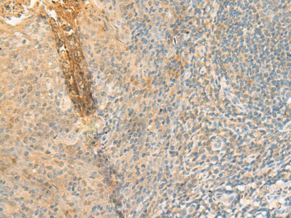 GPT2 Polyclonal Antibody