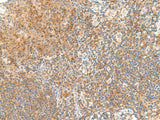 RAPGEF1 Polyclonal Antibody