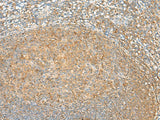 GRHPR Polyclonal Antibody