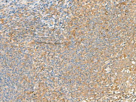 GRIK2 Polyclonal Antibody