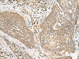 LGALSL Polyclonal Antibody