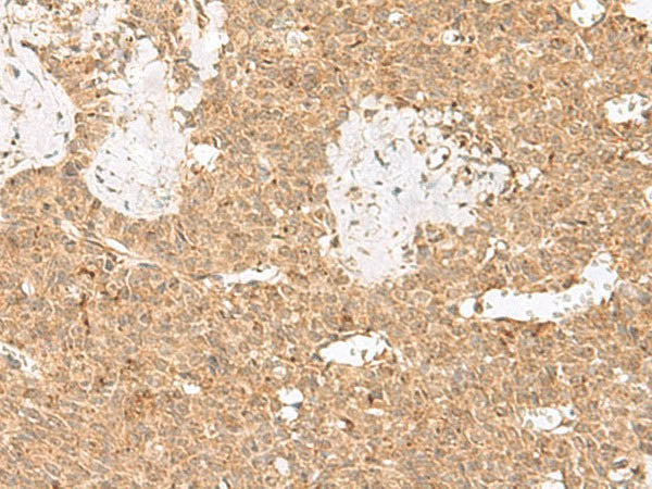 LGALSL Polyclonal Antibody