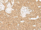 LGALSL Polyclonal Antibody
