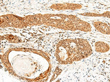 GTF3A Polyclonal Antibody
