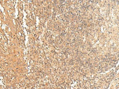 GTF3A Polyclonal Antibody