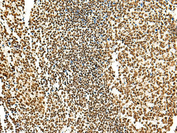 HABP4 Polyclonal Antibody