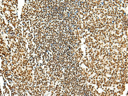 HABP4 Polyclonal Antibody