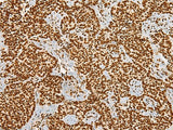HABP4 Polyclonal Antibody