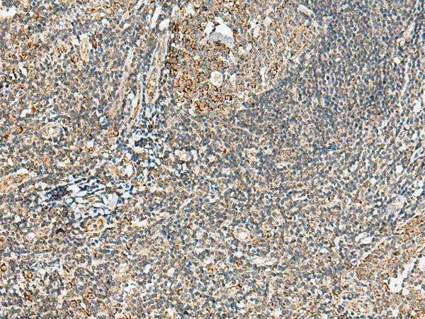 MOB2 Polyclonal Antibody