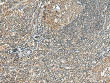 MOB2 Polyclonal Antibody