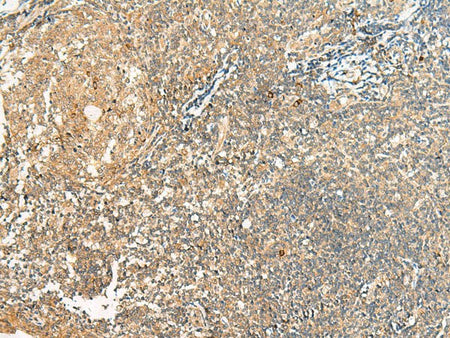 HEBP1 Polyclonal Antibody